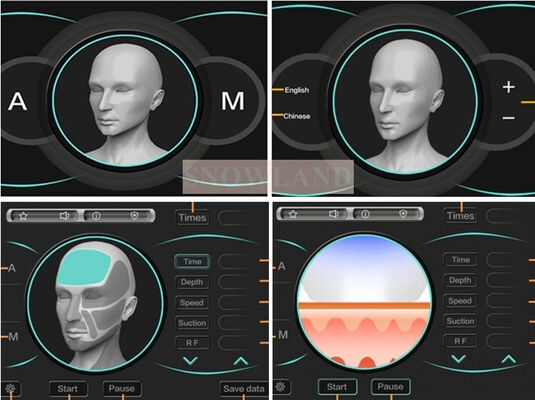 Diode laser 808nm pour l'épilation au laser avec capteur de contact cutané assurant un traitement d'épilation rapide