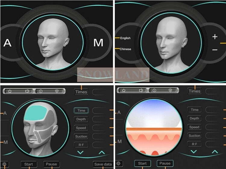 Diode laser 808nm pour l'épilation au laser avec capteur de contact cutané assurant un traitement d'épilation rapide