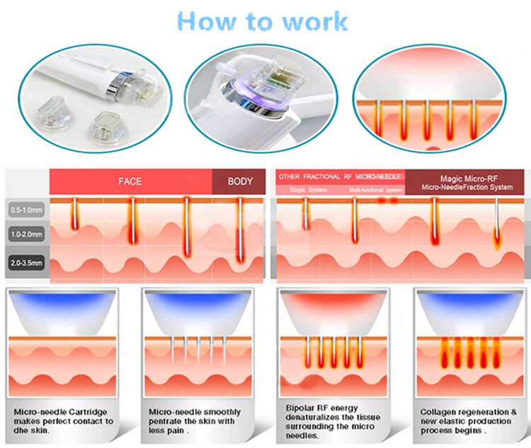 Machine d'épilation au laser à diode 64 58 53CM Quantité 1 Appareil professionnel à fonction d'épilation rapide pour clinique et spa